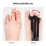 Toe Tractor Bending Curl Overlap Adjustment Foot Protector