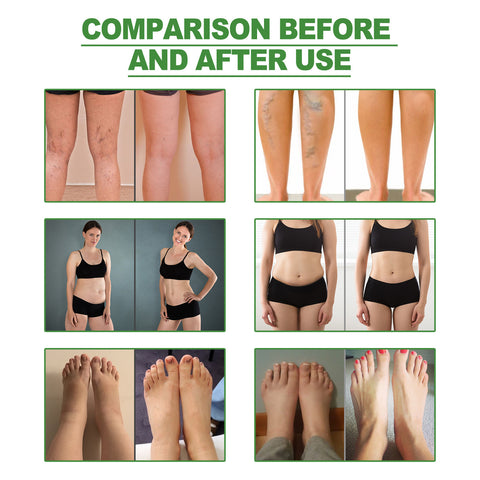 Deep Cleansing Body Foot Care Shaping Foot Patch